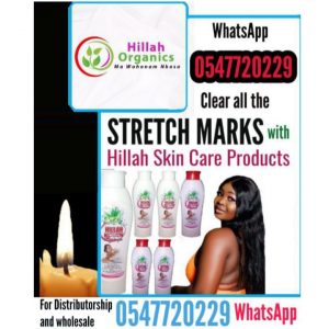 END STRETCH MARKS NOW